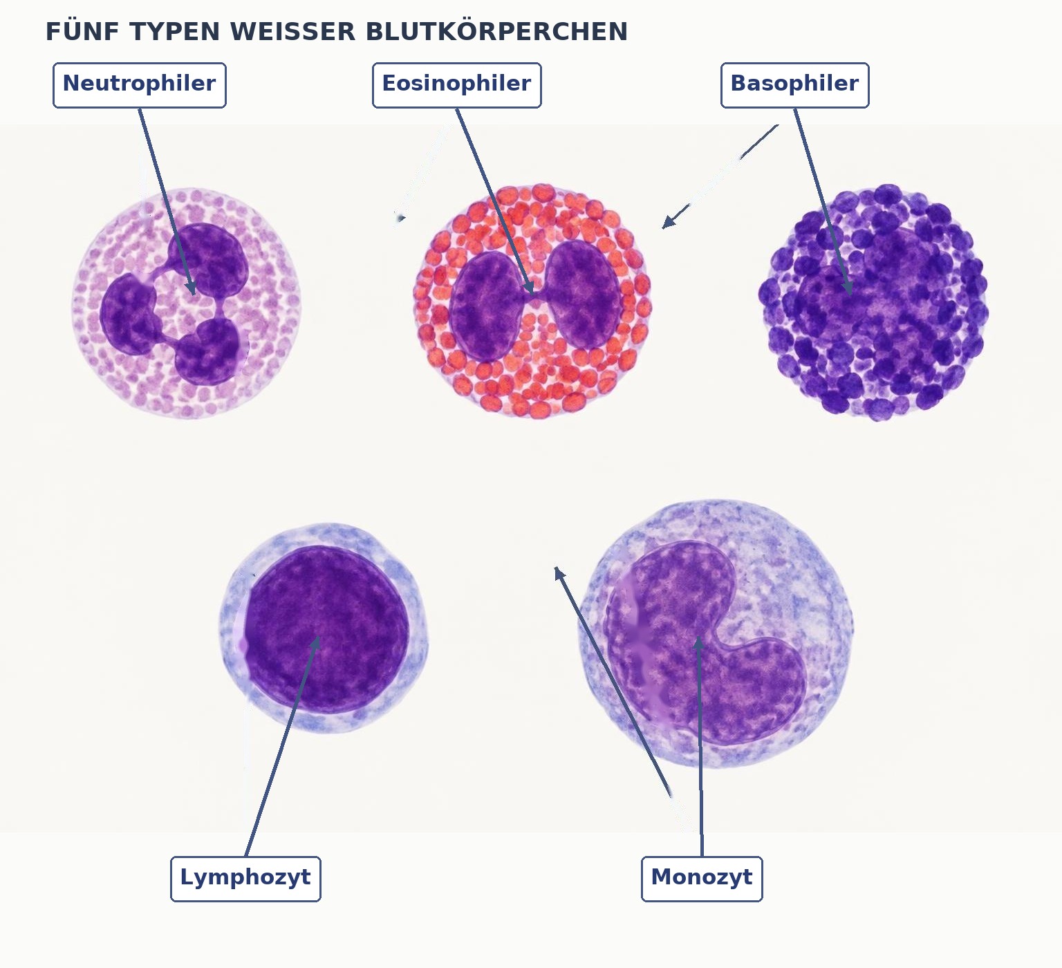 Abb. Fünf Leukozytentypen im Vergleich: Pfeile markieren Neutrophilen, Eosinophilen, Basophilen, Lymphozyten und Monozyten. Schematisch nach gefärbtem Blutausstrich; nicht zur Diagnostik geeignet.