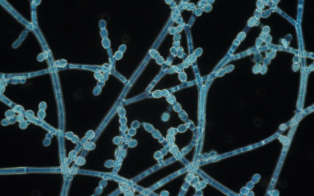 Pilze: Dermatophyt mit septierten Hyphen und Mikrokonidien – Lichtmikroskopie, Färbung.